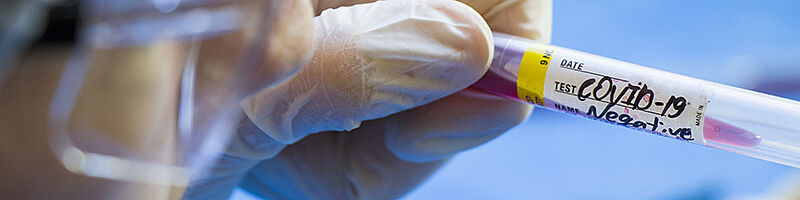 Foto: Person mit Schutzbrille und Einmalhandschuhen hält Teströhrchen mit Probe in der Hand. 